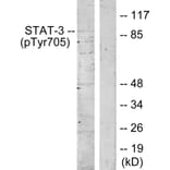 Western Blot - Anti-STAT3 (phospho Tyr705) Antibody (A7224) - Antibodies.com