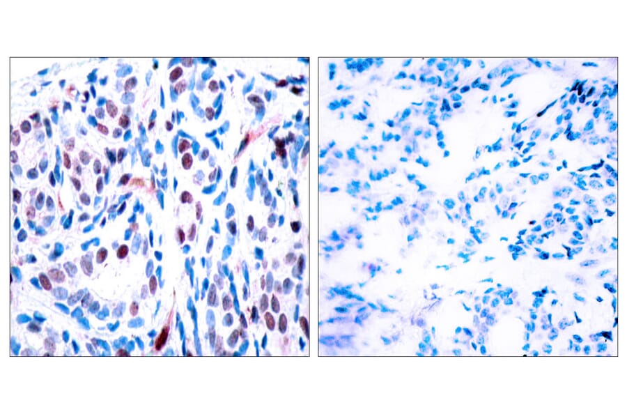 Immunohistochemistry - Anti-STAT3 (phospho Tyr705) Antibody (A7224) - Antibodies.com