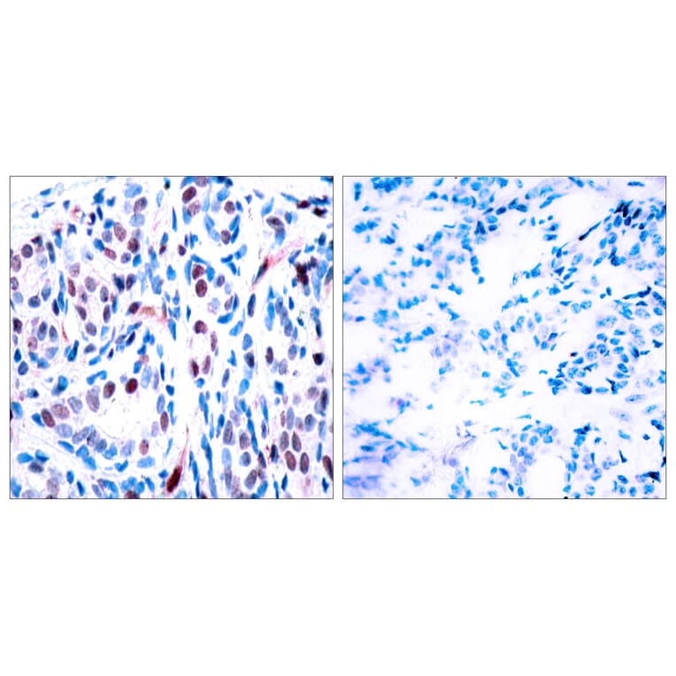 Immunohistochemistry - Anti-STAT3 (phospho Tyr705) Antibody (A7224) - Antibodies.com