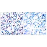Immunohistochemistry - Anti-STAT3 (phospho Tyr705) Antibody (A7224) - Antibodies.com