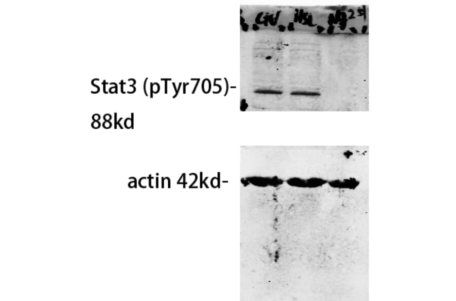 Western Blot - Anti-STAT3 (phospho Tyr705) Antibody (A7224) - Antibodies.com