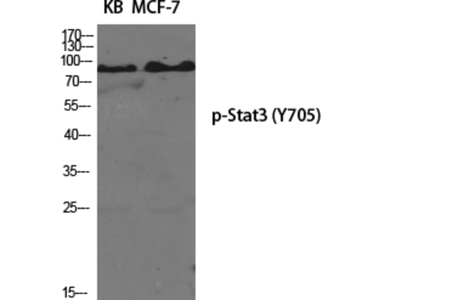 Western Blot - Anti-STAT3 (phospho Tyr705) Antibody (A7224) - Antibodies.com