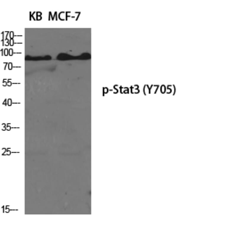 Western Blot - Anti-STAT3 (phospho Tyr705) Antibody (A7224) - Antibodies.com