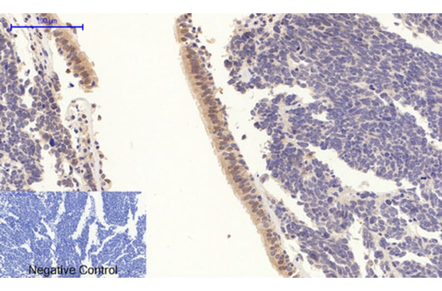 Immunohistochemistry - Anti-STAT3 (phospho Tyr705) Antibody (A7224) - Antibodies.com