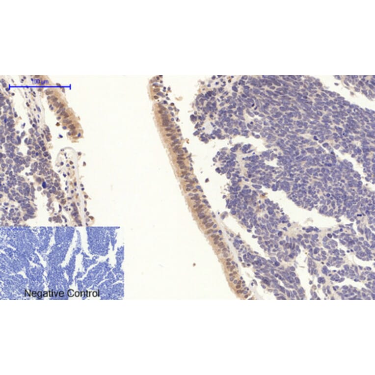 Immunohistochemistry - Anti-STAT3 (phospho Tyr705) Antibody (A7224) - Antibodies.com