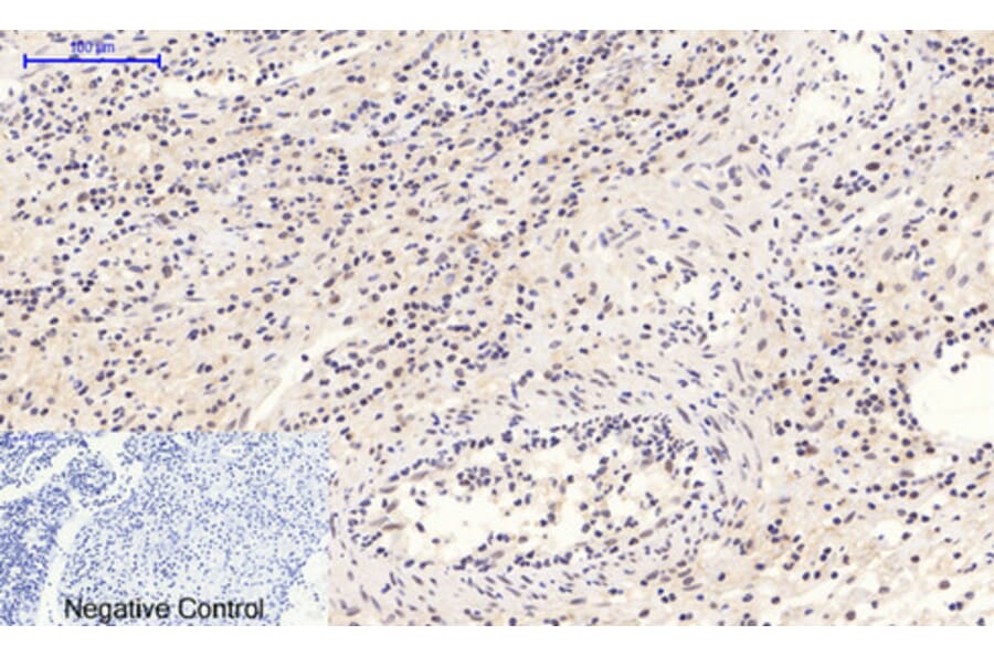 Immunohistochemistry - Anti-STAT3 (phospho Tyr705) Antibody (A7224) - Antibodies.com