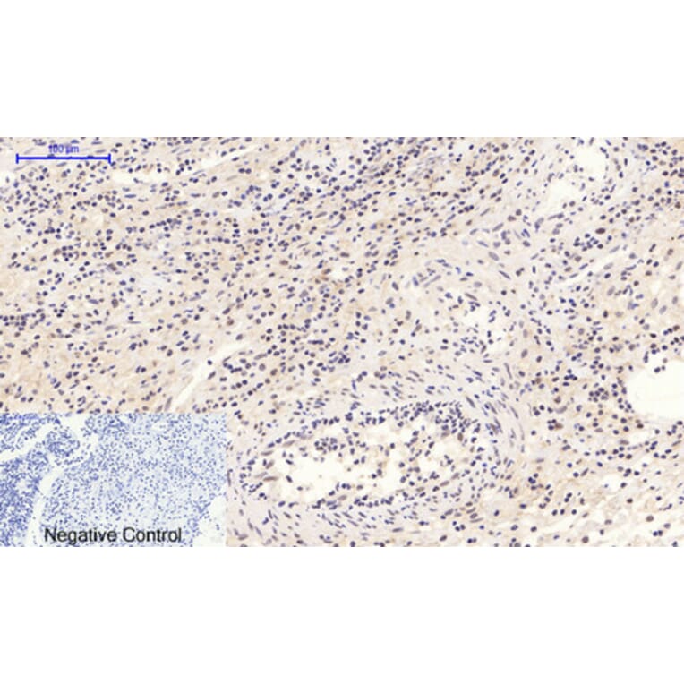 Immunohistochemistry - Anti-STAT3 (phospho Tyr705) Antibody (A7224) - Antibodies.com