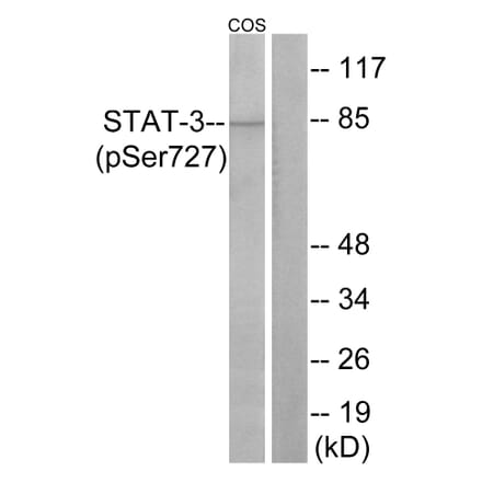 Western Blot - Anti-STAT3 (phospho Ser727) Antibody (A7223) - Antibodies.com