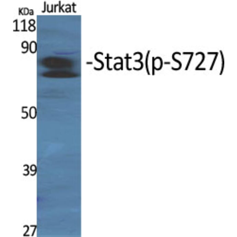 Western Blot - Anti-STAT3 (phospho Ser727) Antibody (A7223) - Antibodies.com