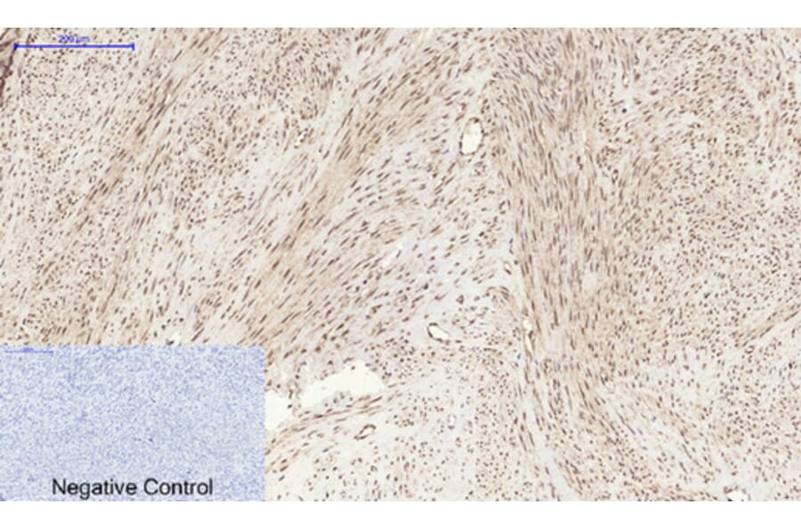 Immunohistochemistry - Anti-STAT3 (phospho Ser727) Antibody (A7223) - Antibodies.com