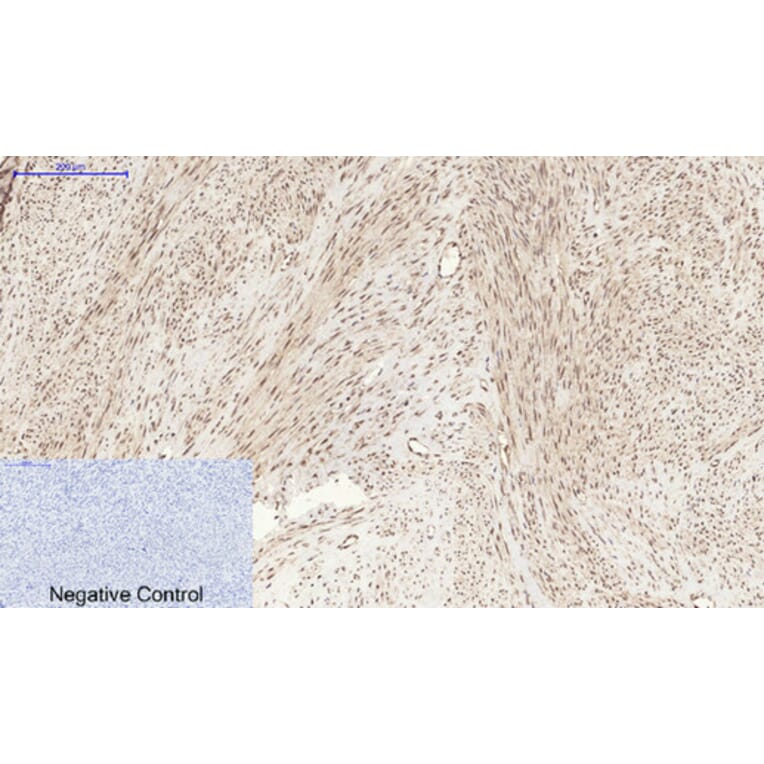 Immunohistochemistry - Anti-STAT3 (phospho Ser727) Antibody (A7223) - Antibodies.com