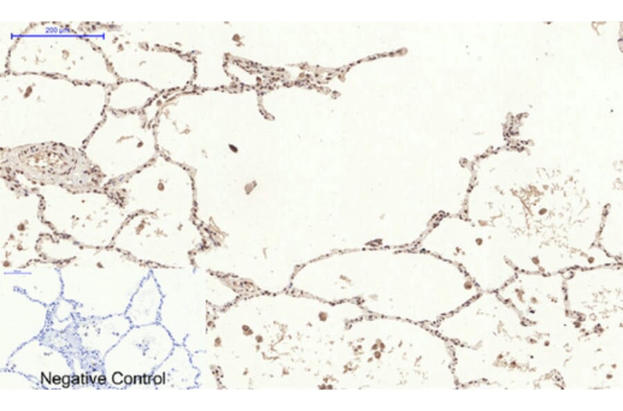 Immunohistochemistry - Anti-STAT3 (phospho Ser727) Antibody (A7223) - Antibodies.com