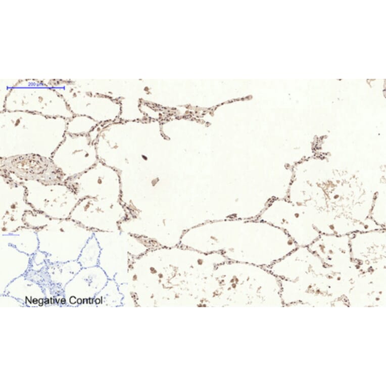Immunohistochemistry - Anti-STAT3 (phospho Ser727) Antibody (A7223) - Antibodies.com