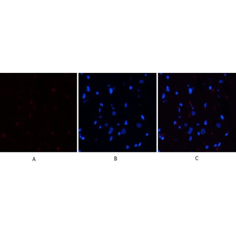 Immunofluorescence - Anti-STAT3 (phospho Ser727) Antibody (A7223) - Antibodies.com