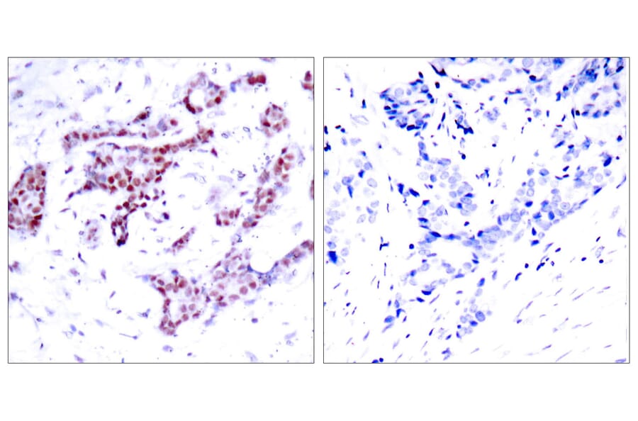 Immunohistochemistry - Anti-STAT1 (phospho Tyr701) Antibody (A7222) - Antibodies.com