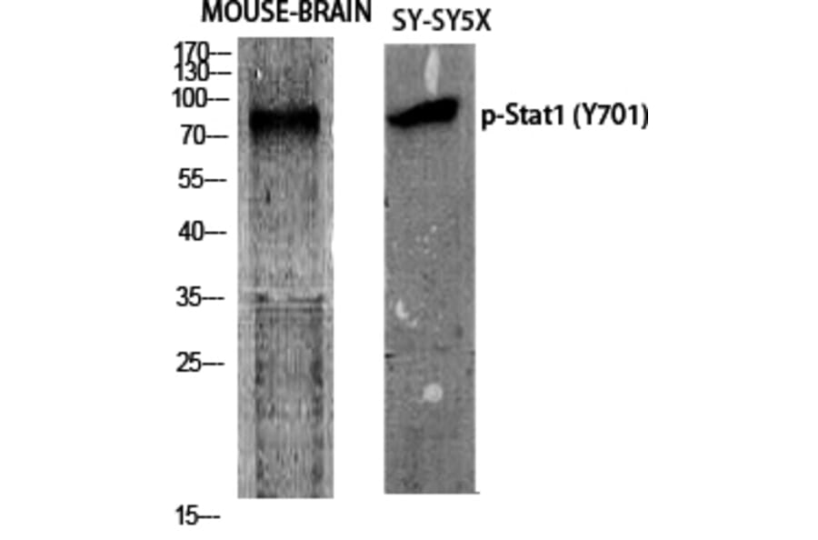 Western Blot - Anti-STAT1 (phospho Tyr701) Antibody (A7222) - Antibodies.com