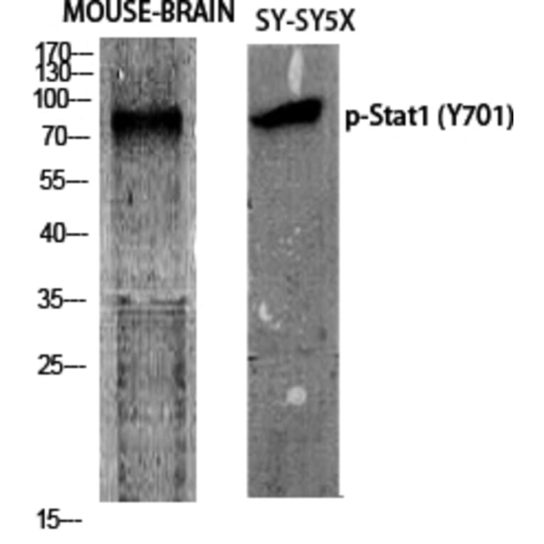 Western Blot - Anti-STAT1 (phospho Tyr701) Antibody (A7222) - Antibodies.com
