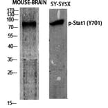 Western Blot - Anti-STAT1 (phospho Tyr701) Antibody (A7222) - Antibodies.com