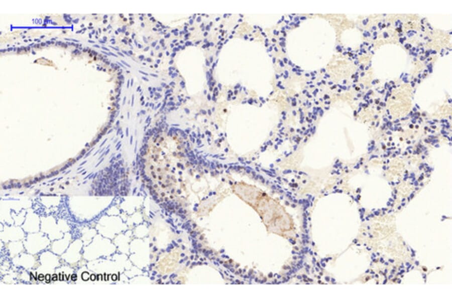 Immunohistochemistry - Anti-STAT1 (phospho Tyr701) Antibody (A7222) - Antibodies.com