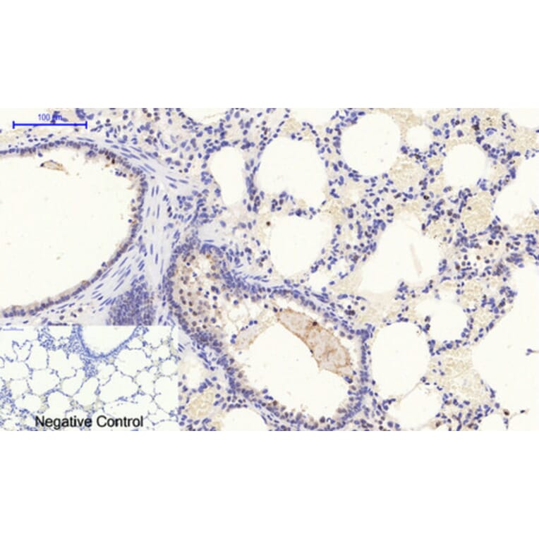 Immunohistochemistry - Anti-STAT1 (phospho Tyr701) Antibody (A7222) - Antibodies.com