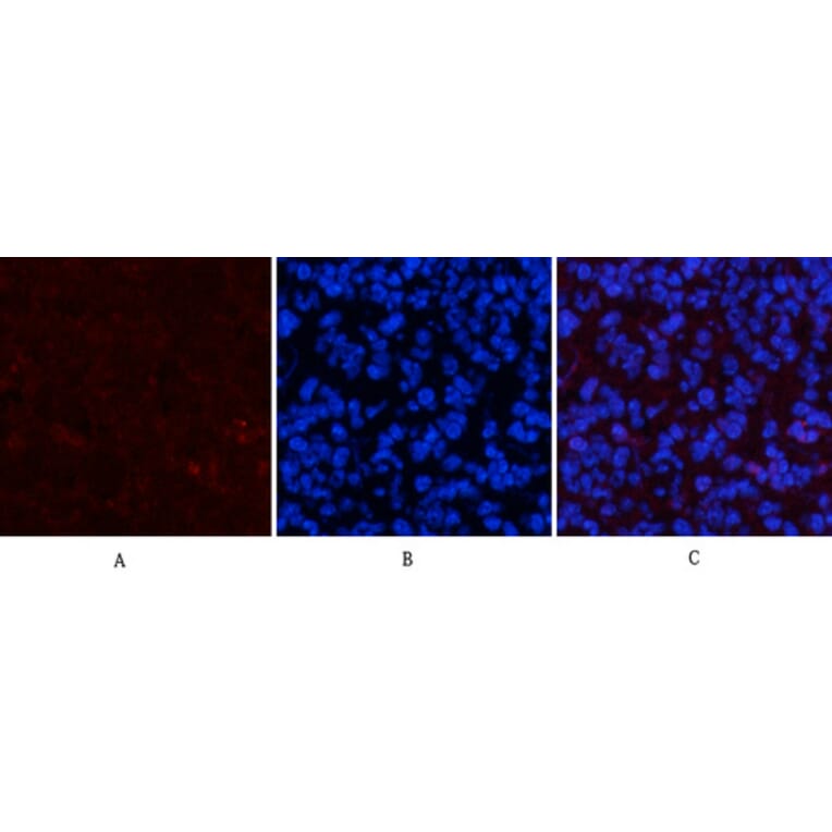 Immunofluorescence - Anti-STAT1 (phospho Tyr701) Antibody (A7222) - Antibodies.com