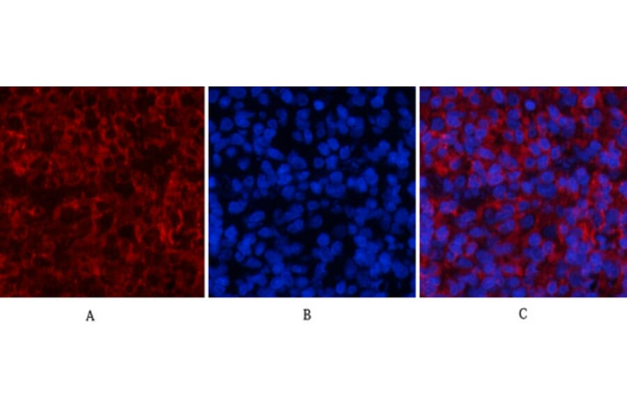 Immunofluorescence - Anti-STAT1 (phospho Tyr701) Antibody (A7222) - Antibodies.com