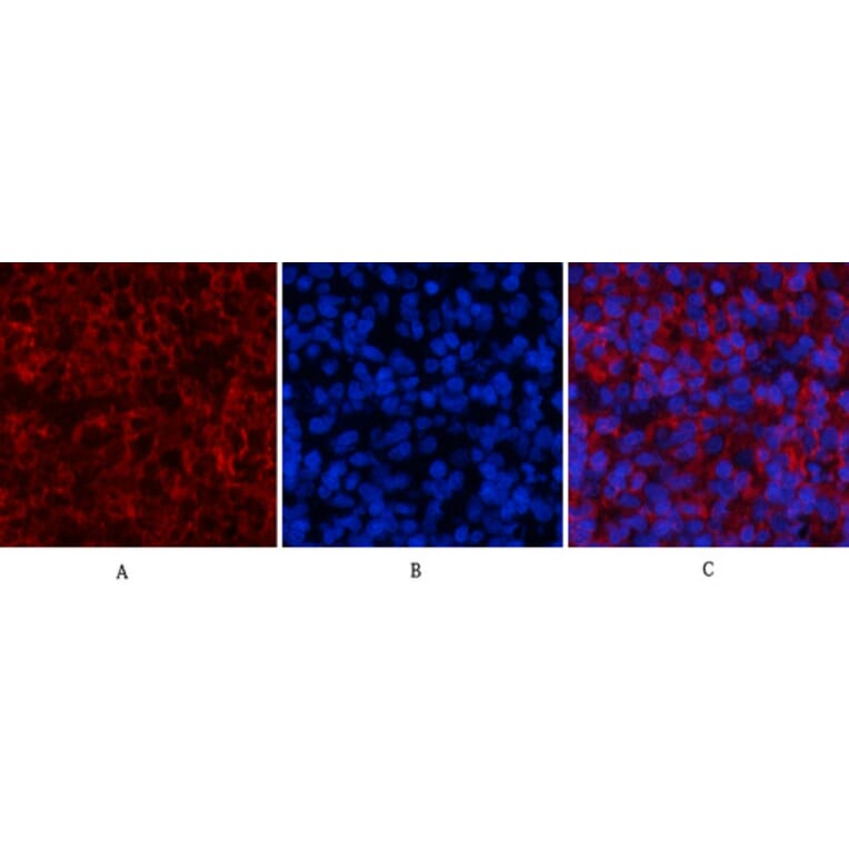 Immunofluorescence - Anti-STAT1 (phospho Tyr701) Antibody (A7222) - Antibodies.com