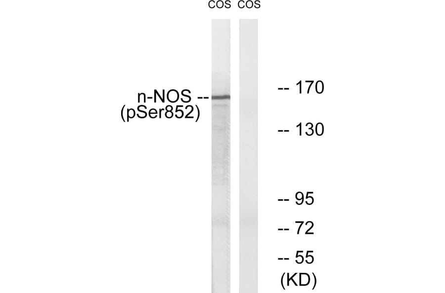 Western Blot - Anti-n-NOS (phospho Ser852) Antibody (A0527) - Antibodies.com