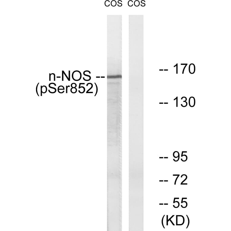 Western Blot - Anti-n-NOS (phospho Ser852) Antibody (A0527) - Antibodies.com