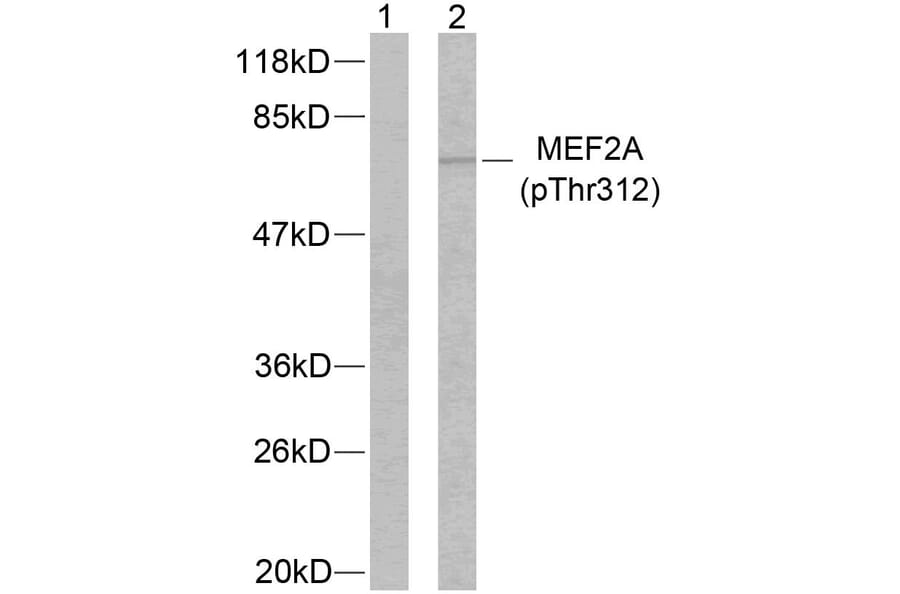 Western Blot - Anti-MEF2A (phospho Thr312) Antibody (A7144) - Antibodies.com