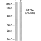 Western Blot - Anti-MEF2A (phospho Thr312) Antibody (A7144) - Antibodies.com