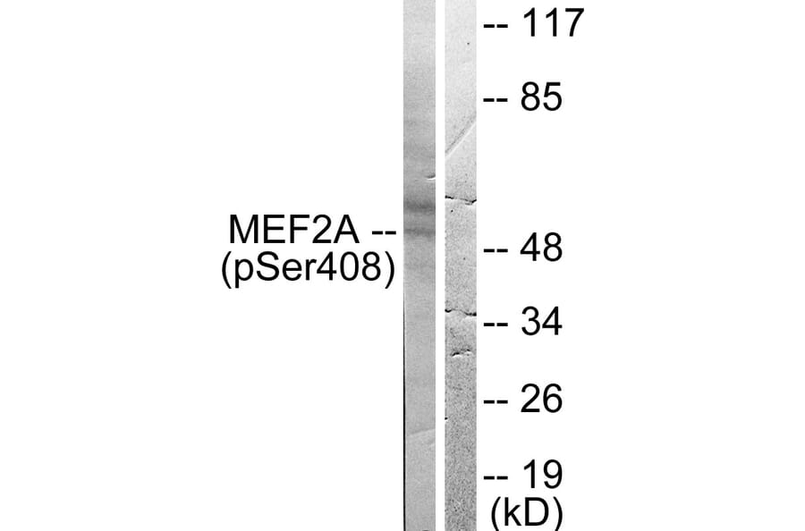 Western Blot - Anti-MEF2A (phospho Ser408) Antibody (A0019) - Antibodies.com