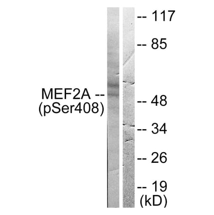 Western Blot - Anti-MEF2A (phospho Ser408) Antibody (A0019) - Antibodies.com