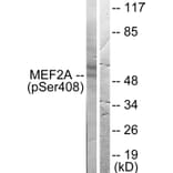 Western Blot - Anti-MEF2A (phospho Ser408) Antibody (A0019) - Antibodies.com