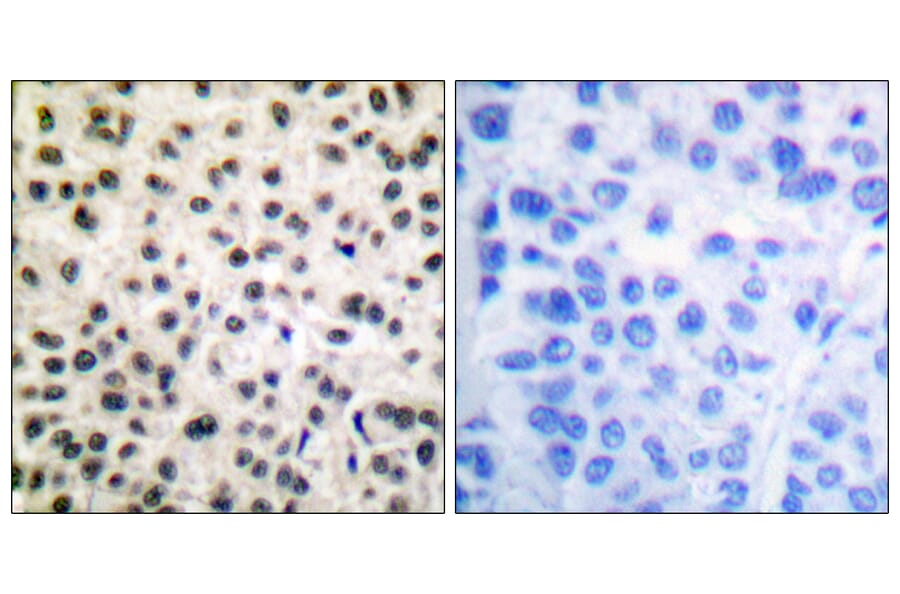 Immunohistochemistry - Anti-MEF2A (phospho Ser408) Antibody (A0019) - Antibodies.com