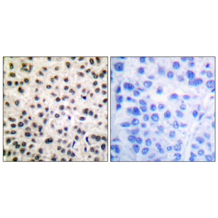 Immunohistochemistry - Anti-MEF2A (phospho Ser408) Antibody (A0019) - Antibodies.com