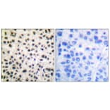 Immunohistochemistry - Anti-MEF2A (phospho Ser408) Antibody (A0019) - Antibodies.com