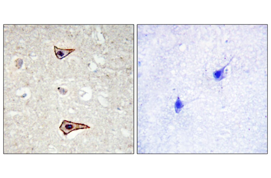 Immunohistochemistry - Anti-Kv1.3 (phospho Tyr135) Antibody (A1085) - Antibodies.com