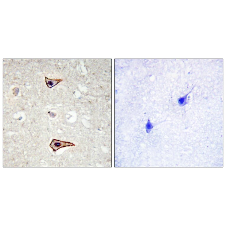 Immunohistochemistry - Anti-Kv1.3 (phospho Tyr135) Antibody (A1085) - Antibodies.com