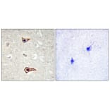 Immunohistochemistry - Anti-Kv1.3 (phospho Tyr135) Antibody (A1085) - Antibodies.com