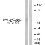 Western Blot - Anti-Kv1.3 (phospho Tyr135) Antibody (A1085) - Antibodies.com