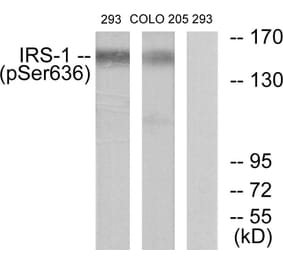 Western Blot - Anti-IRS-1 (phospho Ser636) Antibody (A7122) - Antibodies.com