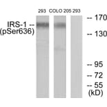 Western Blot - Anti-IRS-1 (phospho Ser636) Antibody (A7122) - Antibodies.com