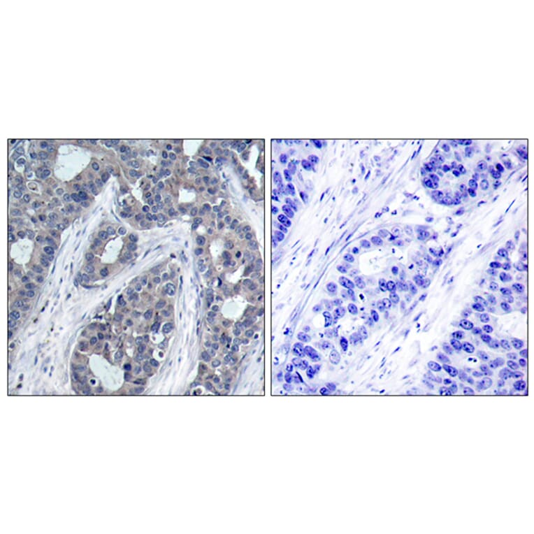 Immunohistochemistry - Anti-IRS-1 (phospho Ser636) Antibody (A7122) - Antibodies.com