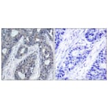 Immunohistochemistry - Anti-IRS-1 (phospho Ser636) Antibody (A7122) - Antibodies.com