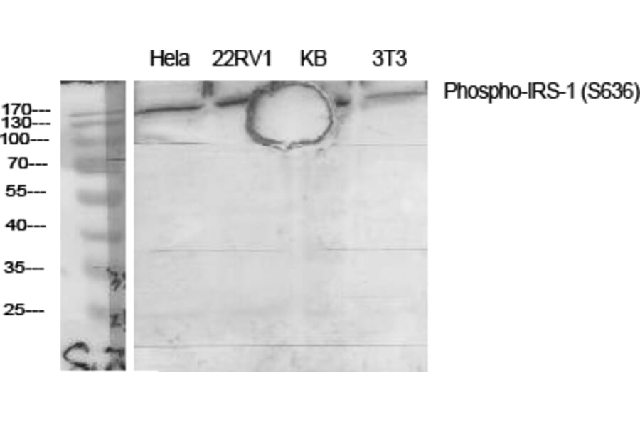 Western Blot - Anti-IRS-1 (phospho Ser636) Antibody (A7122) - Antibodies.com