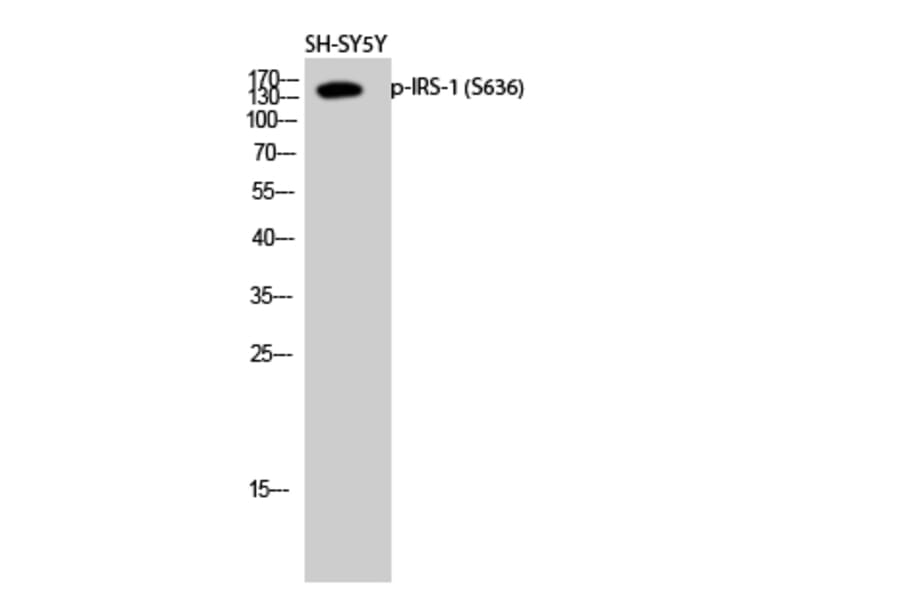 Western Blot - Anti-IRS-1 (phospho Ser636) Antibody (A7122) - Antibodies.com