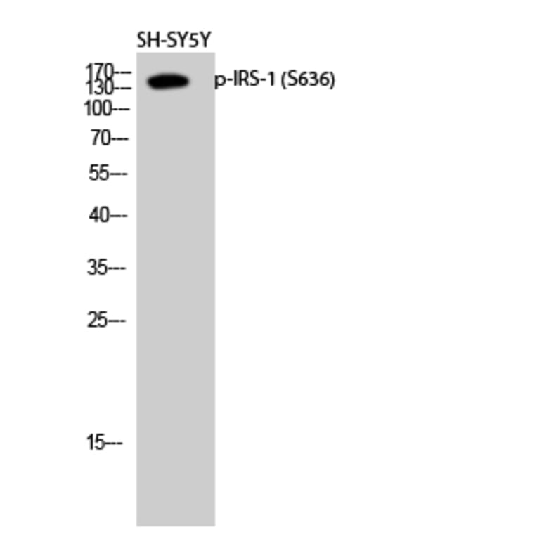 Western Blot - Anti-IRS-1 (phospho Ser636) Antibody (A7122) - Antibodies.com