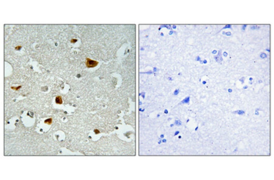 Immunohistochemistry - Anti-IRS-1 (phospho Ser636) Antibody (A7122) - Antibodies.com
