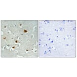 Immunohistochemistry - Anti-IRS-1 (phospho Ser636) Antibody (A7122) - Antibodies.com